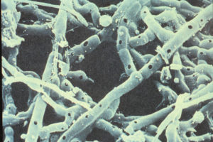 Microbial and faunal soil activity