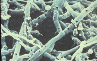 Microbial and faunal soil activity