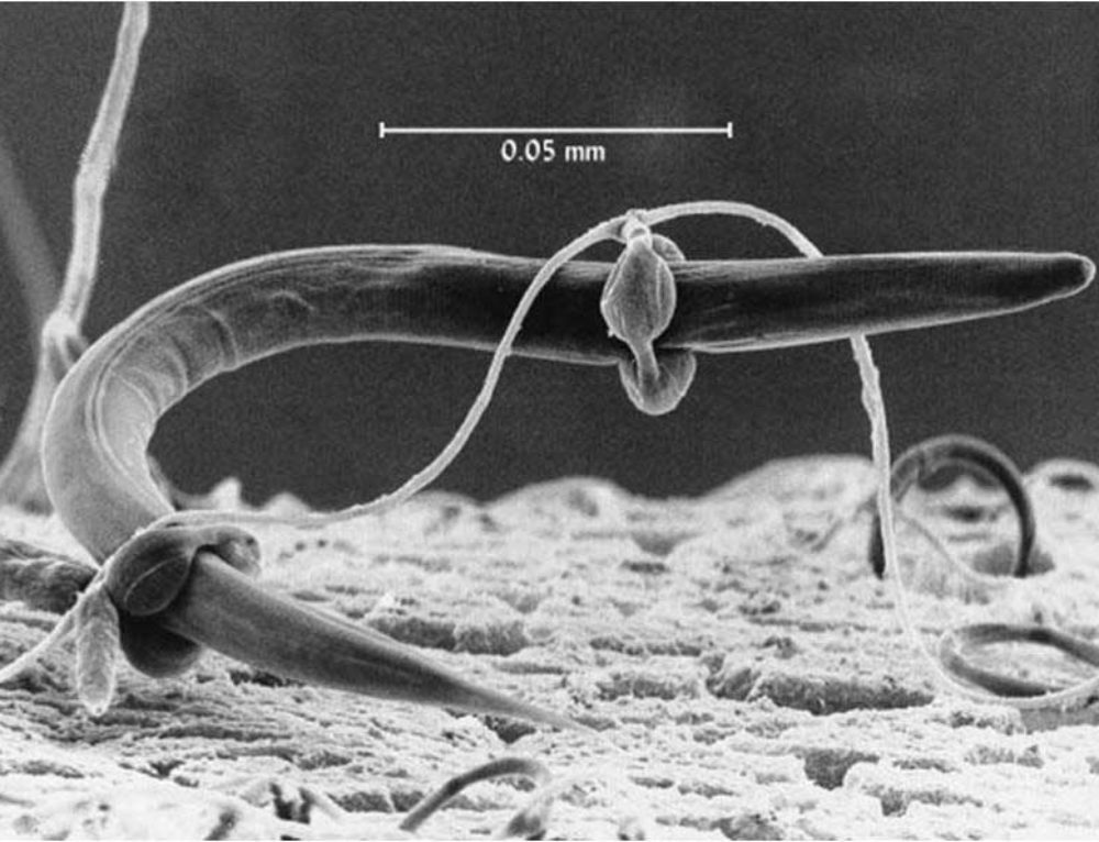 Хищный паразит. Хищные грибы нематода. Хищный гриб Артроботрис. Arthrobotrys oligospora. Гриб Arthrobotrys oligospora.